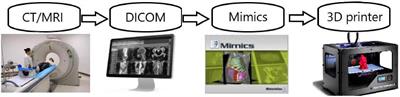 Application of three-dimensional printing technology in renal diseases